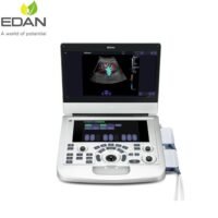 Diagnostic Ultrasound system