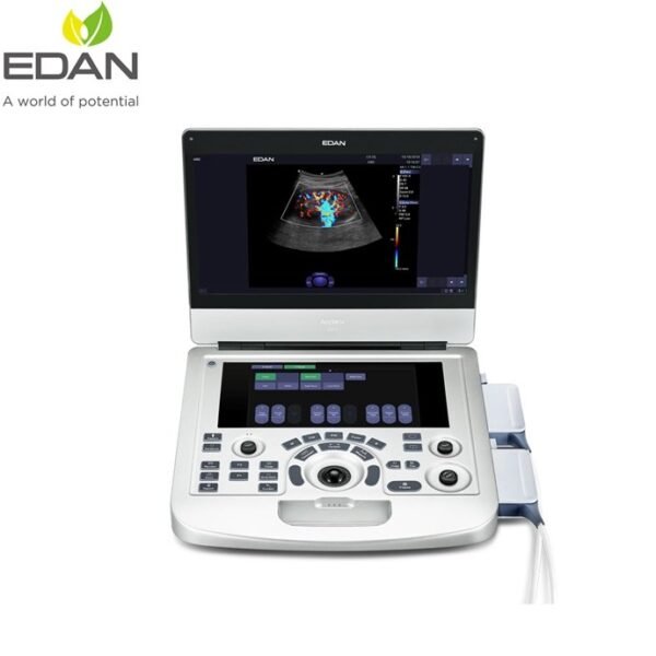 Diagnostic Ultrasound System (Acclarix AX3)