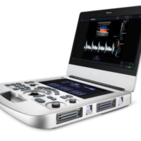 Ultrasound system