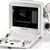 Ultrasound system